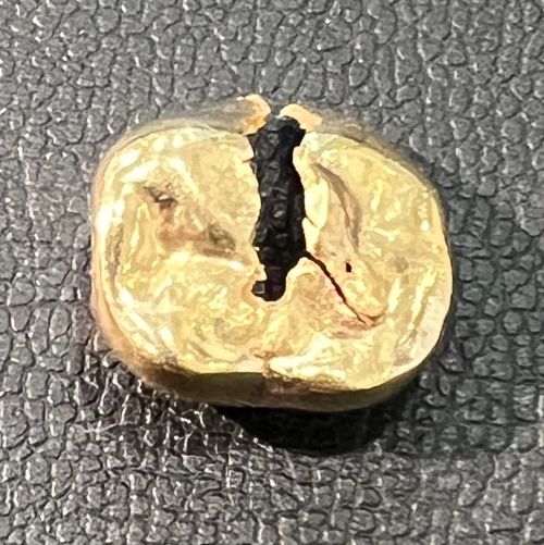 金歯 goldtooth 1本を買取